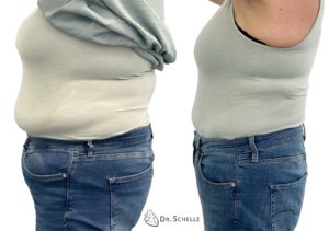 über 20 kg abnehmen, vorher und nachher Foto, Bodytransformation