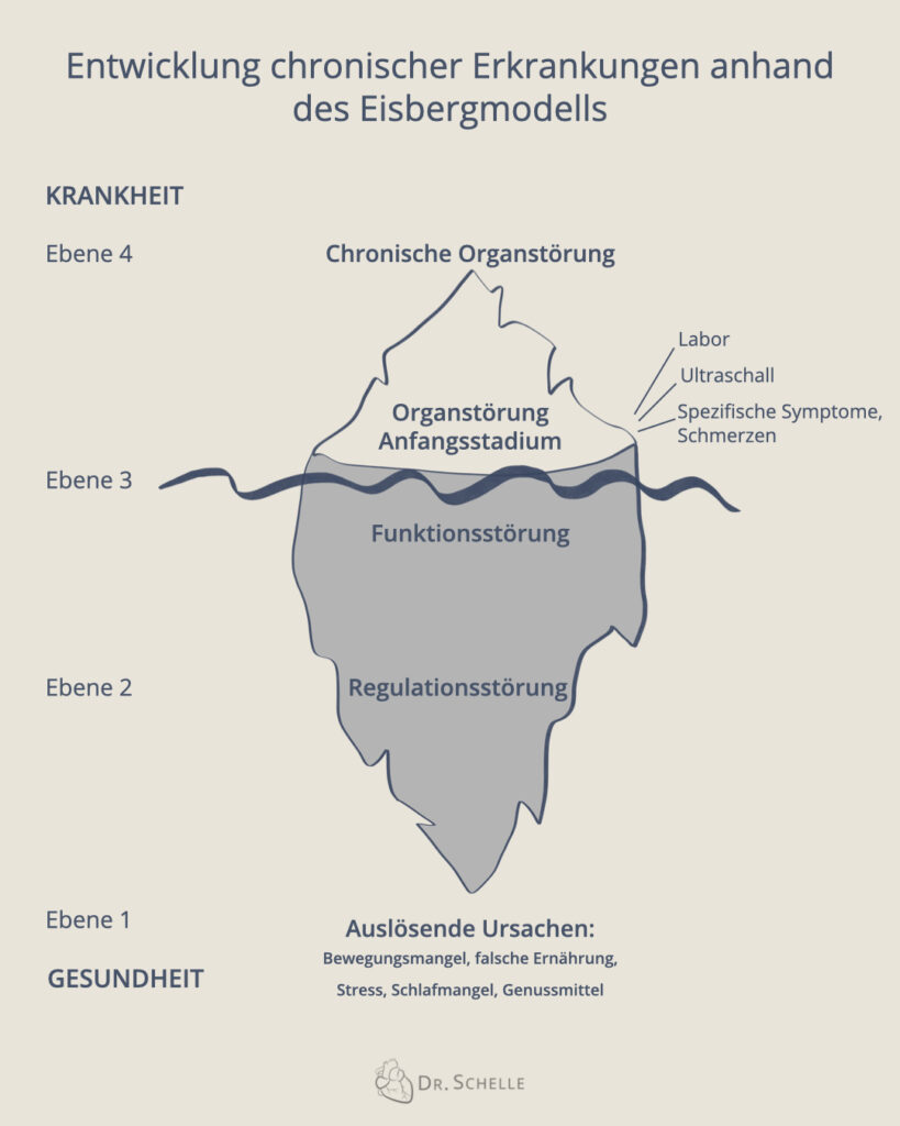 Eisberg Modell Entstehung einer Erkrankung