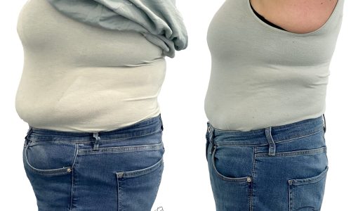 über 20 kg abnehmen, vorher und nachher Foto, Bodytransformation